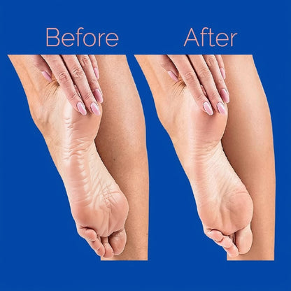 Electric Foot Callus Remover | جهاز إزالة الجلد الميت للقدم